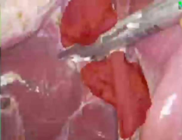 medical teaser
